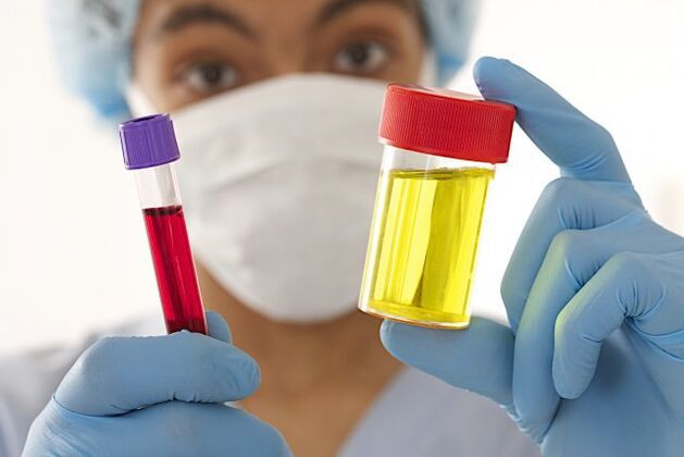 analyses de sang et d'urine pour l'hypertension